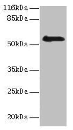 RBMY1F Polyclonal Antibody:Antibodies, Polyclonal