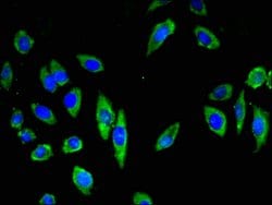 Invitrogen CDH18 Polyclonal Antibody 100 μg; Unconjugated:Antibodies,