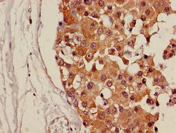 Invitrogen CDH18 Polyclonal Antibody 100 μg; Unconjugated:Antibodies,