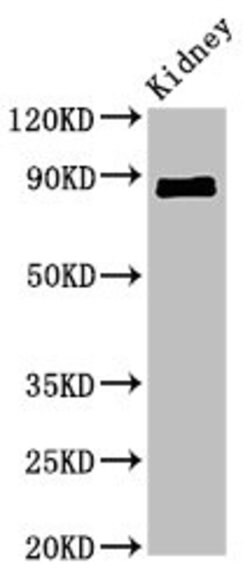 Invitrogen CDH18 Polyclonal Antibody 100 μg; Unconjugated:Antibodies,