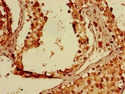 Invitrogen FKBP8 Polyclonal Antibody 100 &mu;g; Unconjugated:Antibodies,