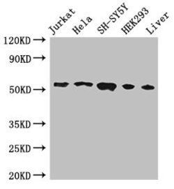 Invitrogen FKBP8 Polyclonal Antibody 100 &mu;g; Unconjugated:Antibodies,