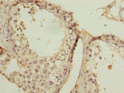 Invitrogen SPCS2 Polyclonal Antibody 100 μg; Unconjugated:Antibodies,