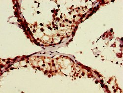 Invitrogen ZRSR2 Polyclonal Antibody 100 μg; Unconjugated:Antibodies,