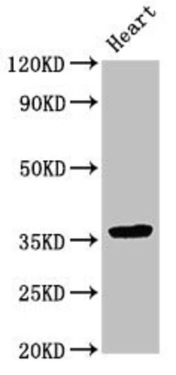 Invitrogen NMI Polyclonal Antibody 100 &mu;g; Unconjugated:Antibodies,