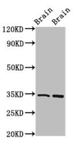 Invitrogen FOXE3 Polyclonal Antibody 100 &mu;g; Unconjugated:Antibodies,