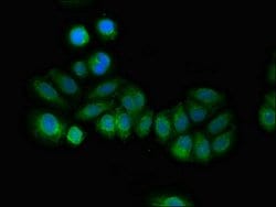 Invitrogen RCAN2 Polyclonal Antibody 100 &mu;g; Unconjugated:Antibodies,