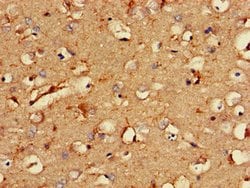 Invitrogen RCAN2 Polyclonal Antibody 100 &mu;g; Unconjugated:Antibodies,