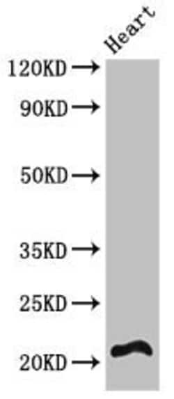 Invitrogen RCAN2 Polyclonal Antibody 100 &mu;g; Unconjugated:Antibodies,
