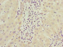 Invitrogen ICAM-4 Polyclonal Antibody 100 &mu;L; Unconjugated:Antibodies,