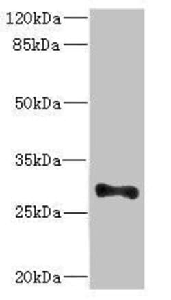 Invitrogen ICAM-4 Polyclonal Antibody 100 &mu;L; Unconjugated:Antibodies,