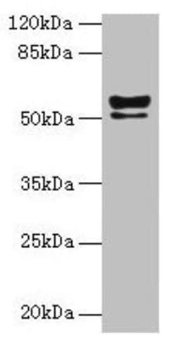 Invitrogen KRT72 Polyclonal Antibody 100 &mu;g | Buy Online | Invitrogen&trade; | Fisher Scientific