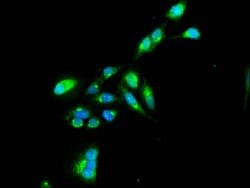 Invitrogen TNIP1 Polyclonal Antibody 100 &mu;g; Unconjugated:Antibodies,
