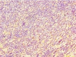 CHI3L2 Polyclonal Antibody:Antibodies, Polyclonal