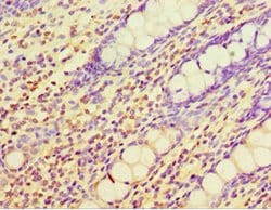 CHI3L2 Polyclonal Antibody:Antibodies, Polyclonal