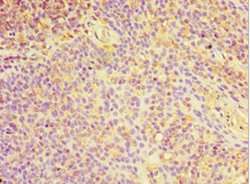 Invitrogen CHI3L2 Polyclonal Antibody 100 &mu;L; Unconjugated:Antibodies,