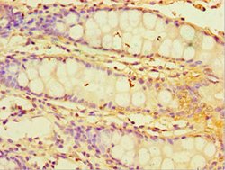 Invitrogen CHI3L2 Polyclonal Antibody 100 &mu;L; Unconjugated:Antibodies,