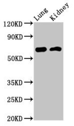 Invitrogen IQCB1 Polyclonal Antibody 100 &mu;g; Unconjugated:Antibodies,