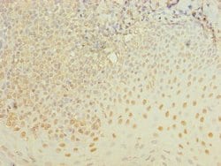 Invitrogen ZBTB6 Polyclonal Antibody 100 &mu;g; Unconjugated:Antibodies,