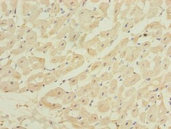 Invitrogen ZBTB6 Polyclonal Antibody 100 &mu;g; Unconjugated:Antibodies,
