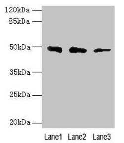 Invitrogen ZBTB6 Polyclonal Antibody 100 &mu;g; Unconjugated:Antibodies,