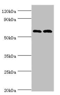 Invitrogen PAK2 Polyclonal Antibody 100 &mu;L; Unconjugated:Antibodies,