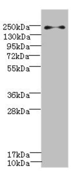 Invitrogen PLA2R1 Polyclonal Antibody 100 μL; Unconjugated:Antibodies,
