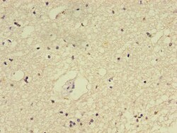 Invitrogen E2F2 Polyclonal Antibody 100 &mu;g; Unconjugated:Antibodies,