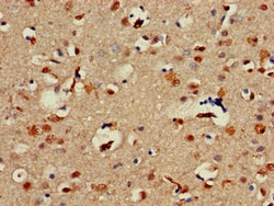 Invitrogen ALX1 Polyclonal Antibody 100 &mu;g; Unconjugated:Antibodies,