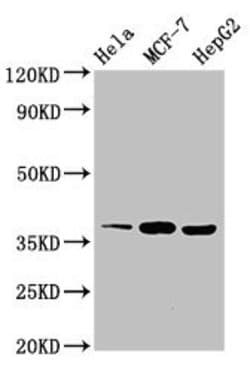 Invitrogen ALX1 Polyclonal Antibody 100 &mu;g; Unconjugated:Antibodies,