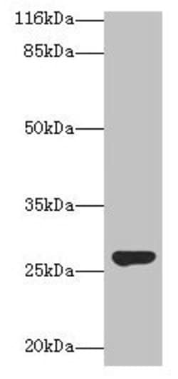 Invitrogen IZUMO4 Polyclonal Antibody 100 &mu;g; Unconjugated:Antibodies,