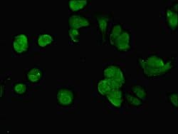 Invitrogen SWI5 Polyclonal Antibody 100 &mu;g; Unconjugated:Antibodies,