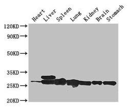 Invitrogen SWI5 Polyclonal Antibody 100 &mu;g; Unconjugated:Antibodies,