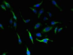 Invitrogen SLC4A8 Polyclonal Antibody 100 &mu;g; Unconjugated:Antibodies,