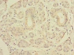 Invitrogen SLC4A8 Polyclonal Antibody 100 &mu;g; Unconjugated:Antibodies,