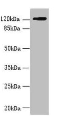 Invitrogen SLC4A8 Polyclonal Antibody 100 &mu;g; Unconjugated:Antibodies,