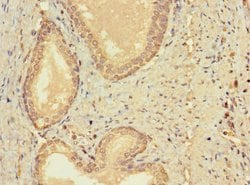 Invitrogen CERKL Polyclonal Antibody 100 &mu;g; Unconjugated:Antibodies,