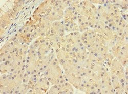 Invitrogen CERKL Polyclonal Antibody 100 &mu;g; Unconjugated:Antibodies,