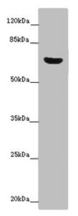 Invitrogen CERKL Polyclonal Antibody 100 &mu;g; Unconjugated:Antibodies,
