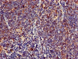 Invitrogen C1orf177 Polyclonal Antibody 100 &mu;g | Buy Online | Invitrogen&trade; | Fisher Scientific