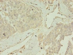 Invitrogen CCDC14 Polyclonal Antibody 100 &mu;g; Unconjugated:Antibodies,