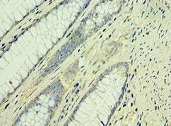 Invitrogen TAF1B Polyclonal Antibody 100 &mu;L | Buy Online | Invitrogen&trade; | Fisher Scientific