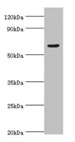 Invitrogen TAF1B Polyclonal Antibody 100 &mu;L | Buy Online | Invitrogen&trade; | Fisher Scientific