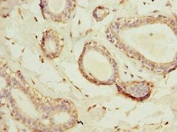 Invitrogen HSD17B12 Polyclonal Antibody 100 μg; Unconjugated:Antibodies,