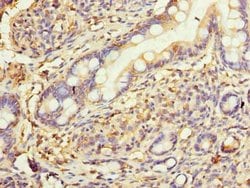 Invitrogen HSD17B12 Polyclonal Antibody 100 μg; Unconjugated:Antibodies,