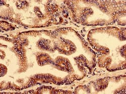 Invitrogen YIF1B Polyclonal Antibody 100 &mu;g; Unconjugated:Antibodies,