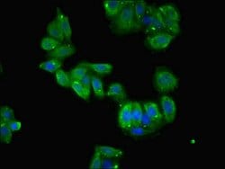 Invitrogen TCTE1 Polyclonal Antibody 100 &mu;g; Unconjugated:Antibodies,