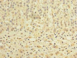 Invitrogen TCTE1 Polyclonal Antibody 100 &mu;g; Unconjugated:Antibodies,