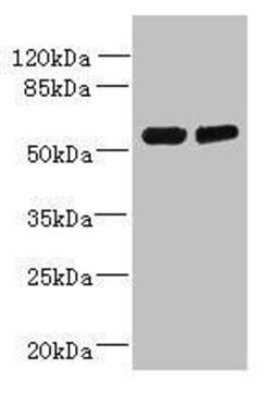 Invitrogen TCTE1 Polyclonal Antibody 100 &mu;g; Unconjugated:Antibodies,
