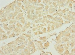 Invitrogen TNNI3K Polyclonal Antibody 100 &mu;L; Unconjugated:Antibodies,
